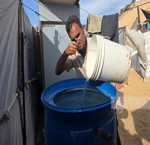 עזה — מוחמד א־נוואג'חה נפצע באורח קשה בתקיפה ישראלית, זרועו נקטעה, וכעת הוא ממתין לאישור יציאה מהרצועה כדי לעבור התאמה של יד תותבת.