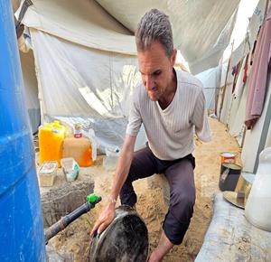 עזה — מוחמד א־נוואג'חה נפצע באורח קשה בתקיפה ישראלית, זרועו נקטעה, וכעת הוא ממתין לאישור יציאה מהרצועה כדי לעבור התאמה של יד תותבת.