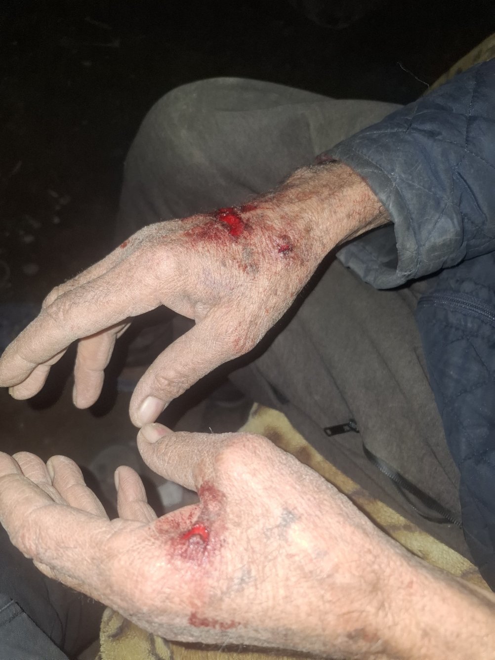 בקעת הירדן הצפונית: מתנחלים תקפו תושב באזור אל-מאלח