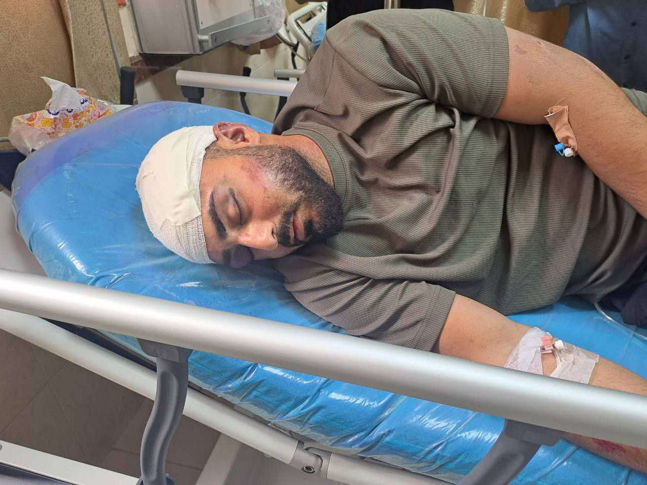 חיילי הכיבוש תקפו ופצעו צעיר בצפון יריחו