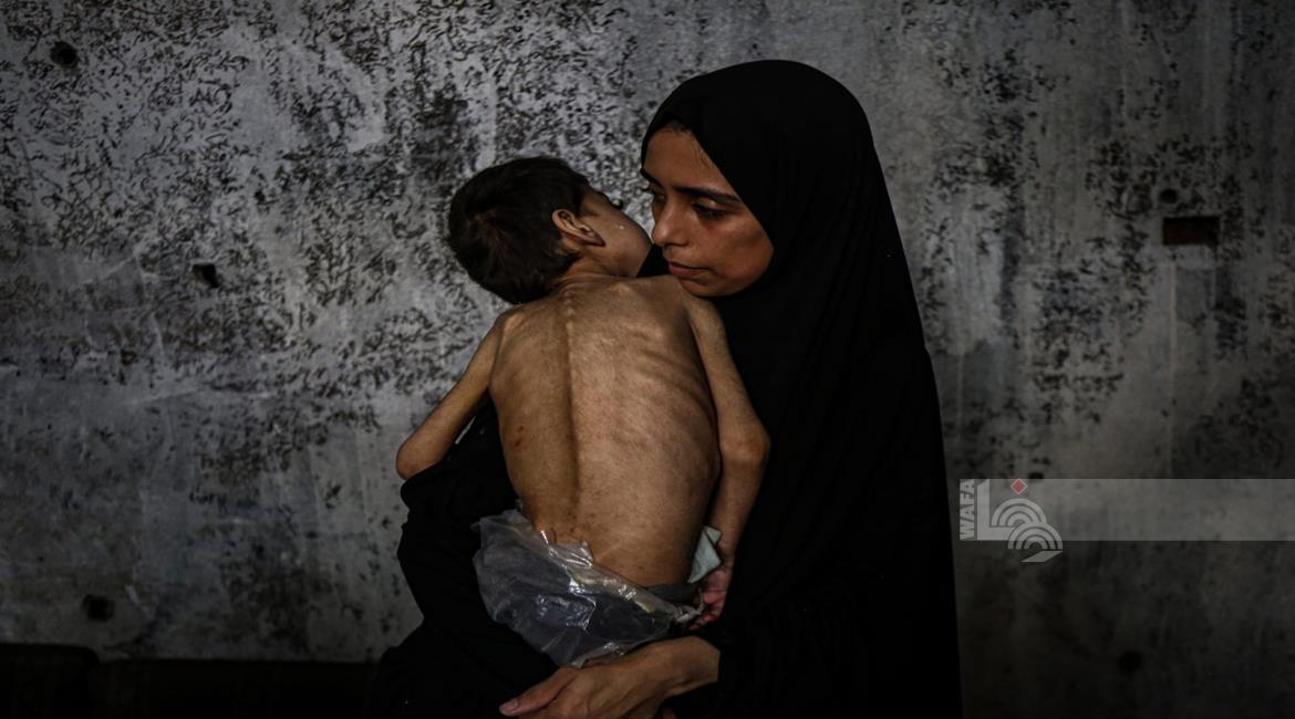 חמישה מתים, בהם ילד, בעקבות רעב ותת־תזונה בעזה ביממה האחרונה