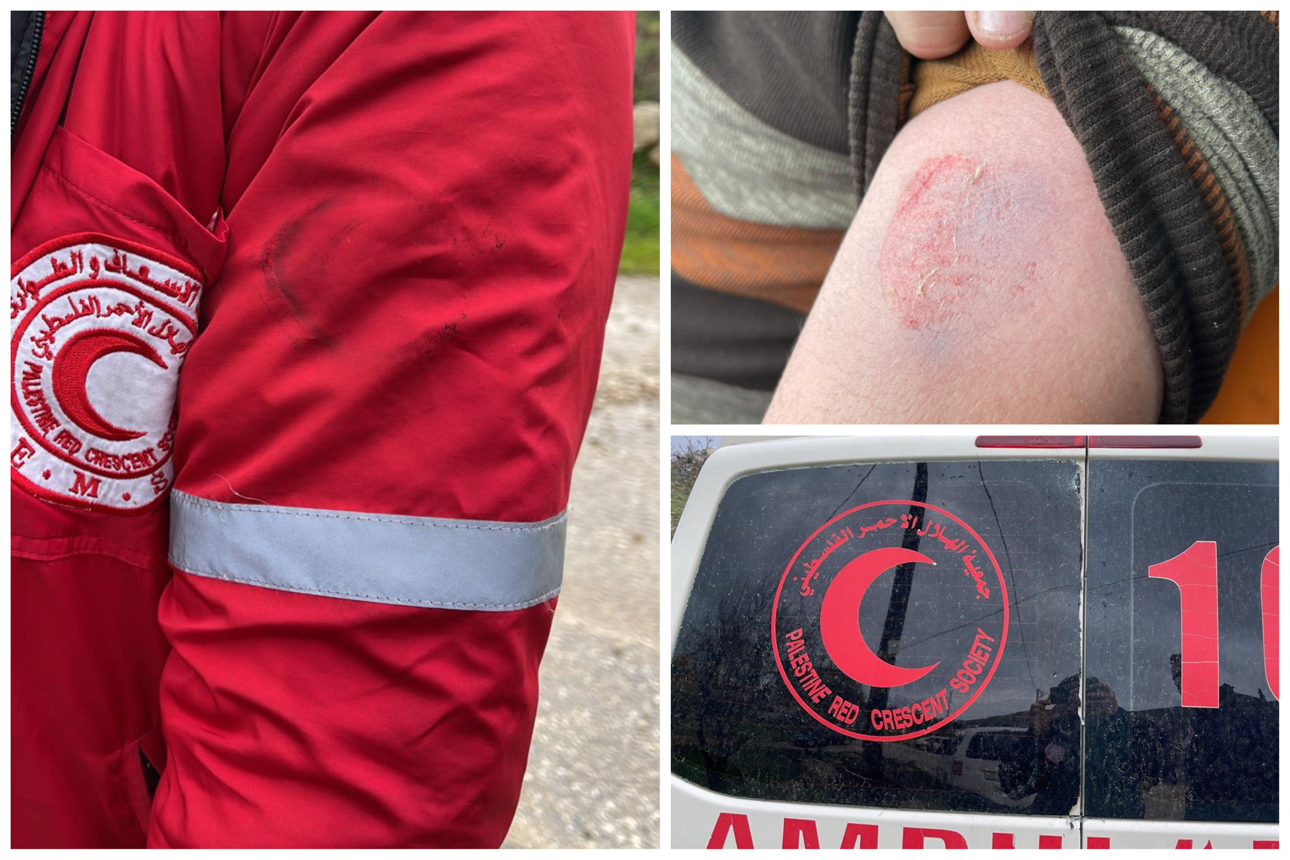 עשרות פצועים מירי כדורי גומי ומשאיפת גז מדמיע