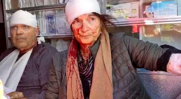 פעילי רבנים לזכויות אדם הוכו באכזריות בידי מתנחלים