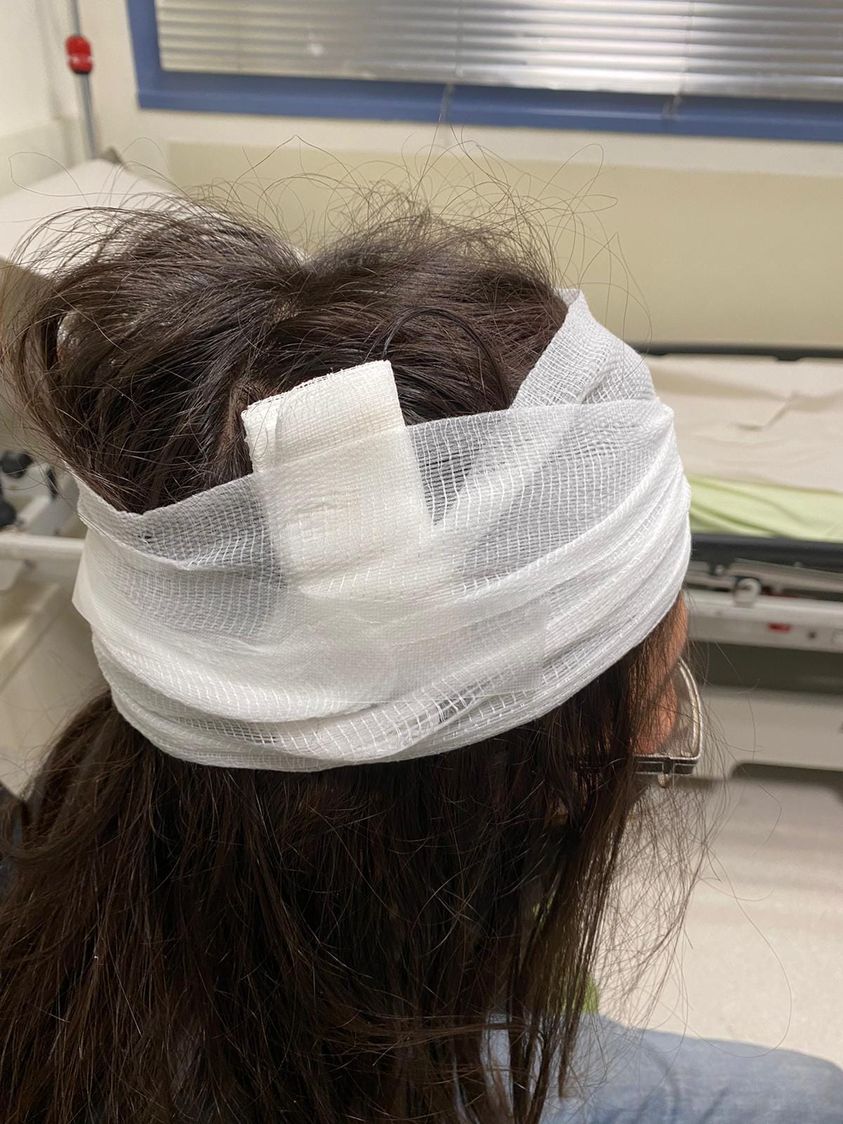 מתנחל "דפק" באלה פעיל נגד הכיבוש בראשו