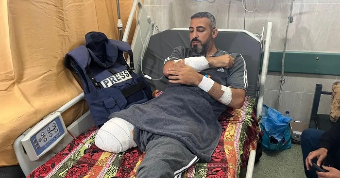 איגוד העיתונאים: 1,639 הפרות ופגיעות בעיתונאים מאז תחילת מלחמת ההשמדה