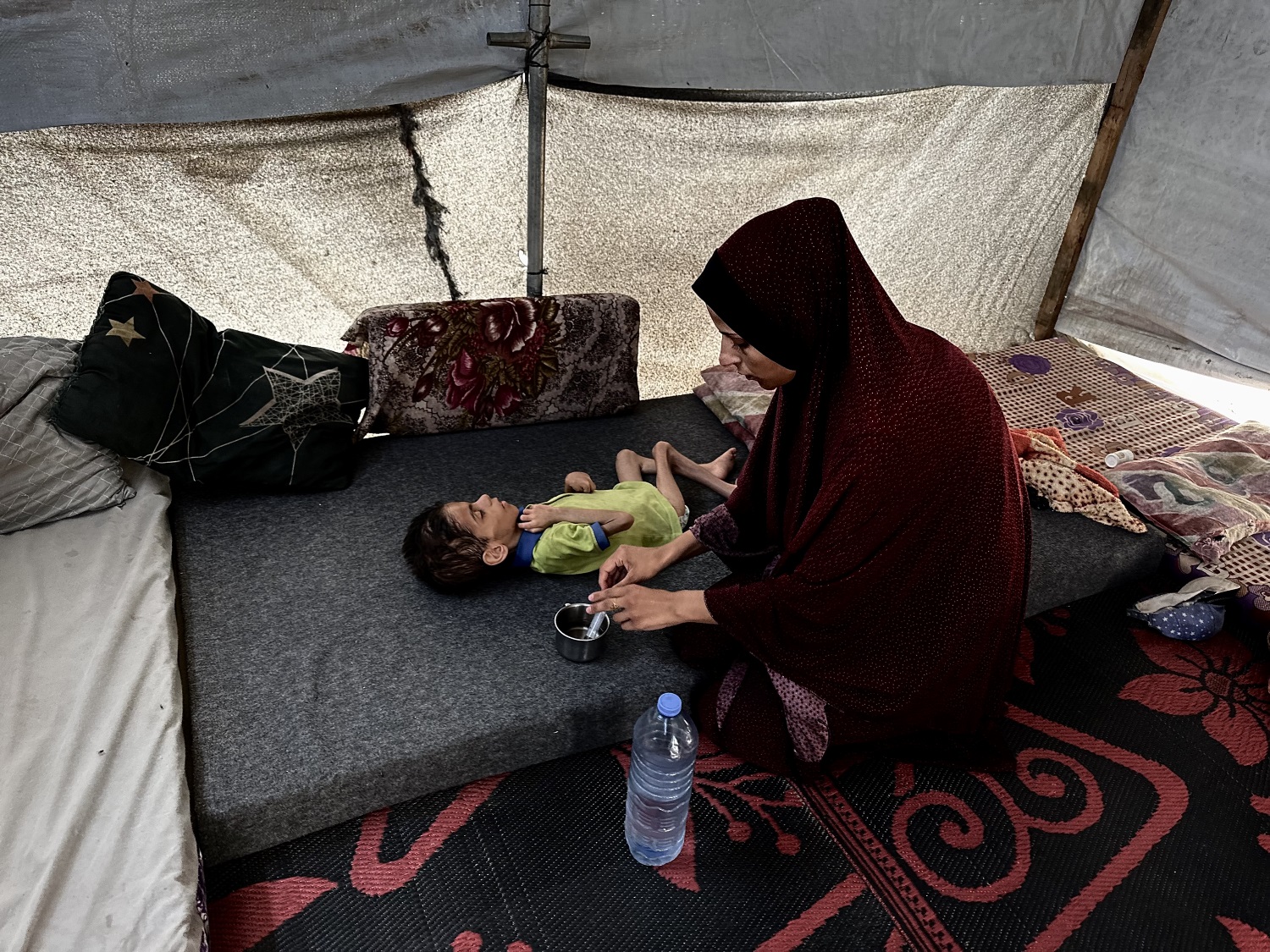 תינוק בעזה: חיים תחת מלחמה מסתיימים במחלה מוחית קשה