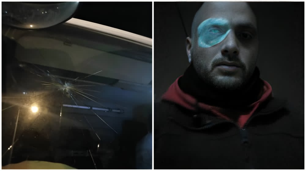 פצוע בתקיפת מתנחלים מזרחית לבית לחם