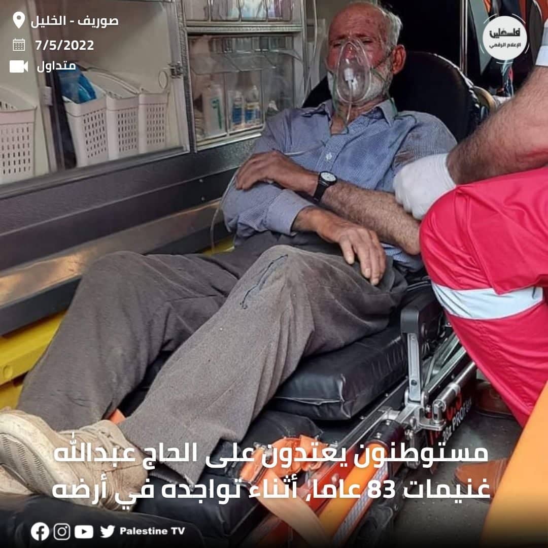 יהודים תקפו באכזריות בן 83 ושברו את ידו