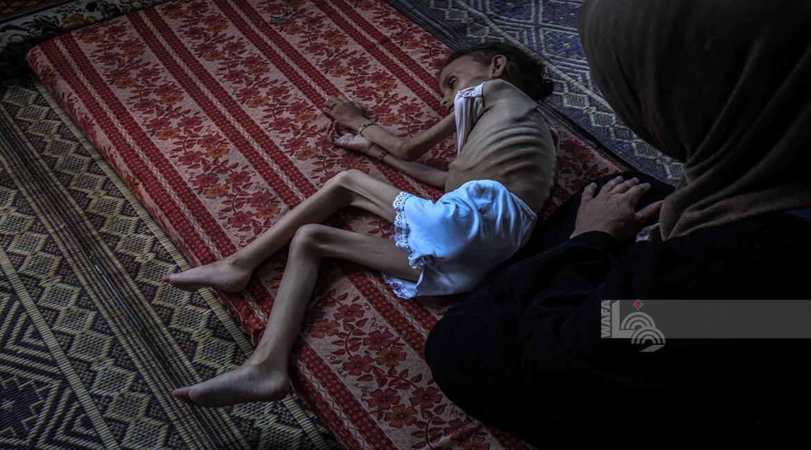 טורק: התמונות מעזה – אנשים גוועים ברעב, מראות מזעזעים ובלתי נסבלים