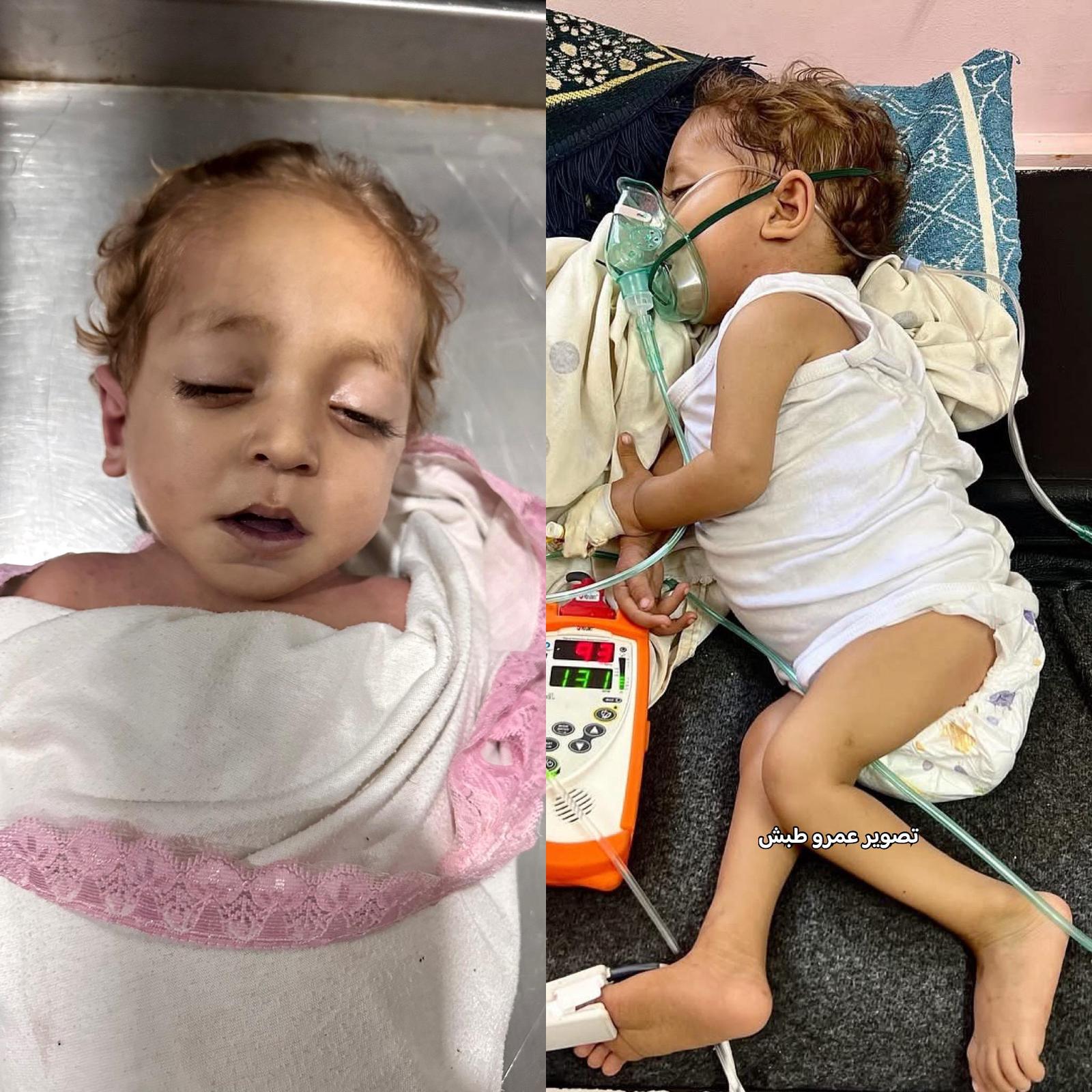 המערכת הרפואית קרסה – הילד חסן ברבח מת לאחר שנמנע ממנו טיפול רפואי