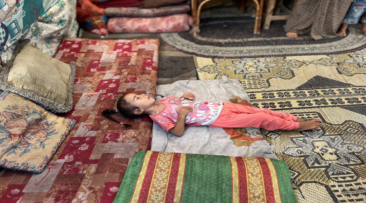 האו״ם: תת־תזונה חמורה בקרב ילדים בעזה הגיעה לשיא כל הזמנים