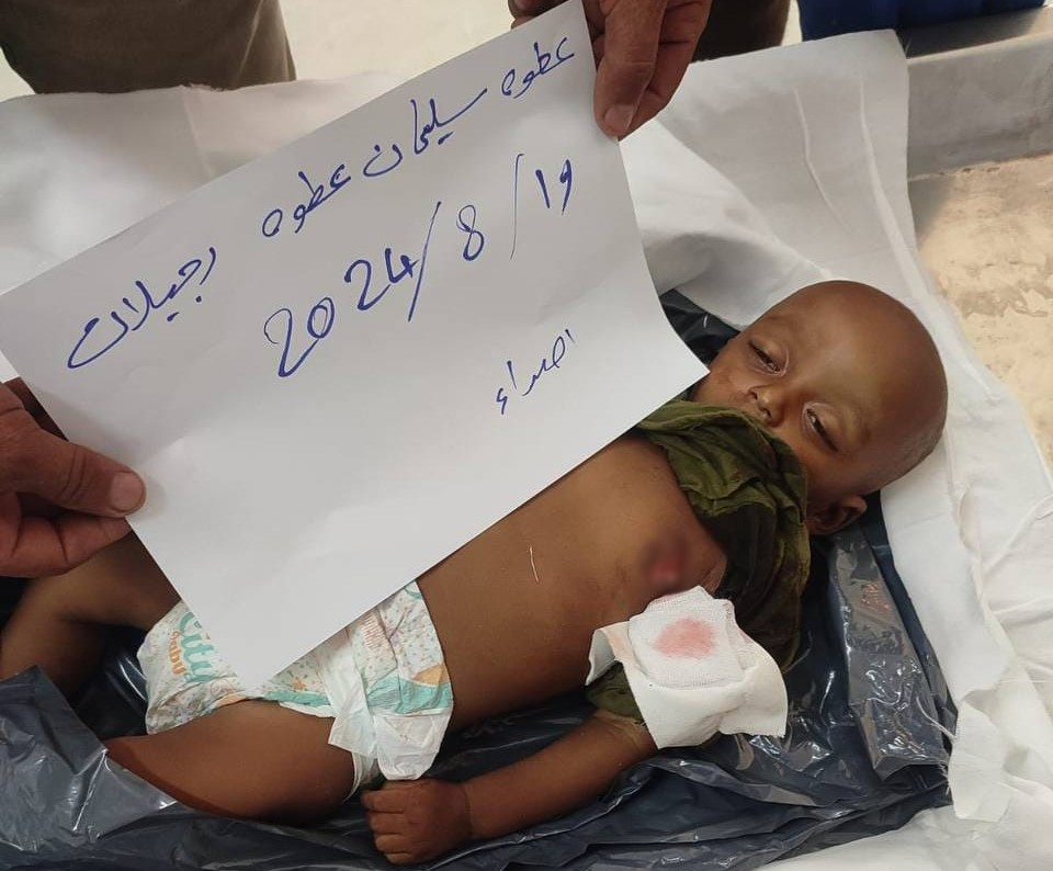 המצור על עזה גובה את חייו של תינוק נוסף: עטווה, בן ה-8 חודשים, נולד ומת במלחמה