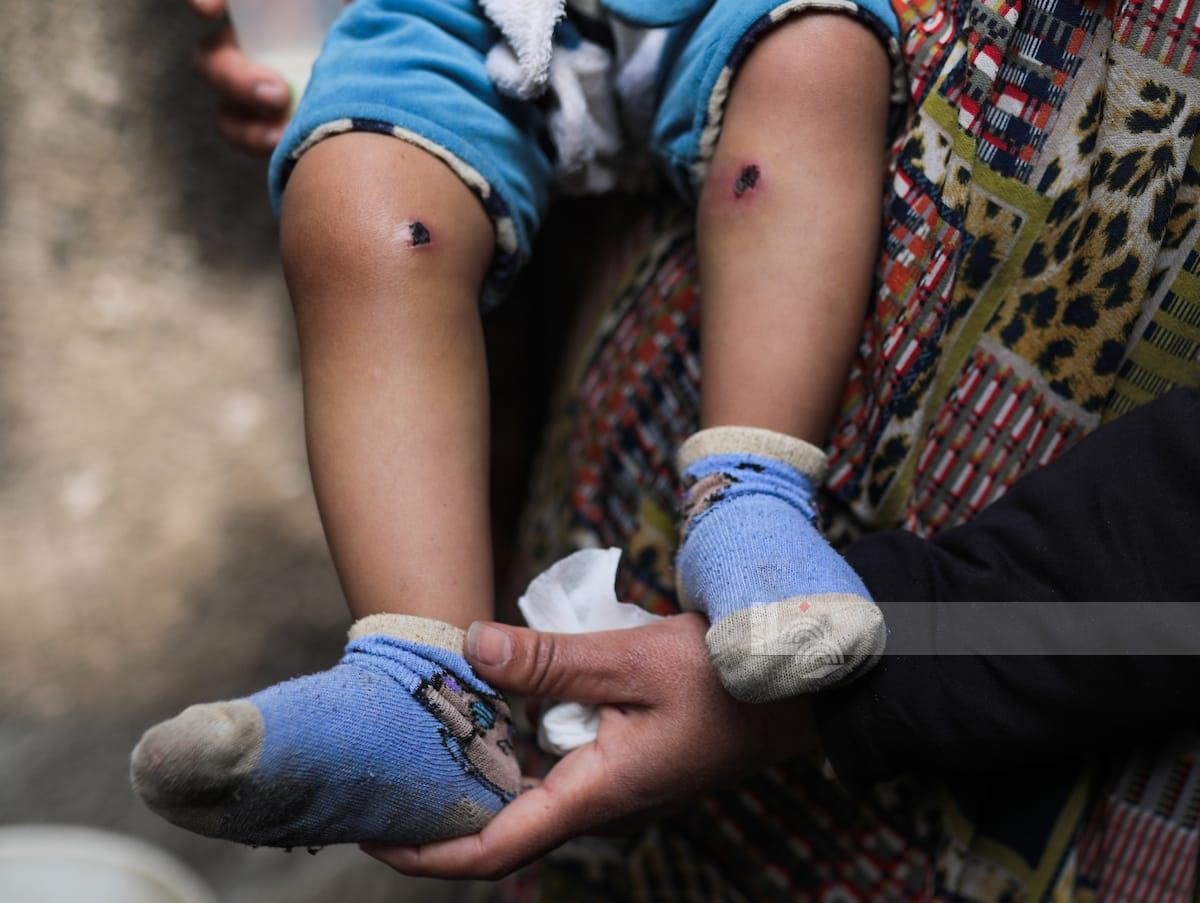 הם חטפו אותו ואת אביו — והחזירו אותו עם כוויות ברגליים