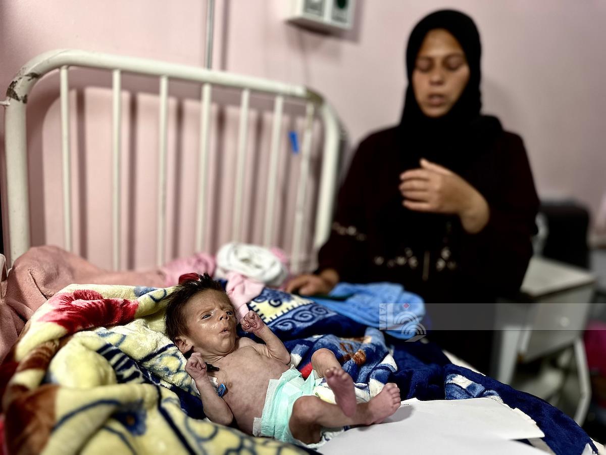 חמישה מתים מרעב ותת־תזונה ב־24 השעות האחרונות בעזה
