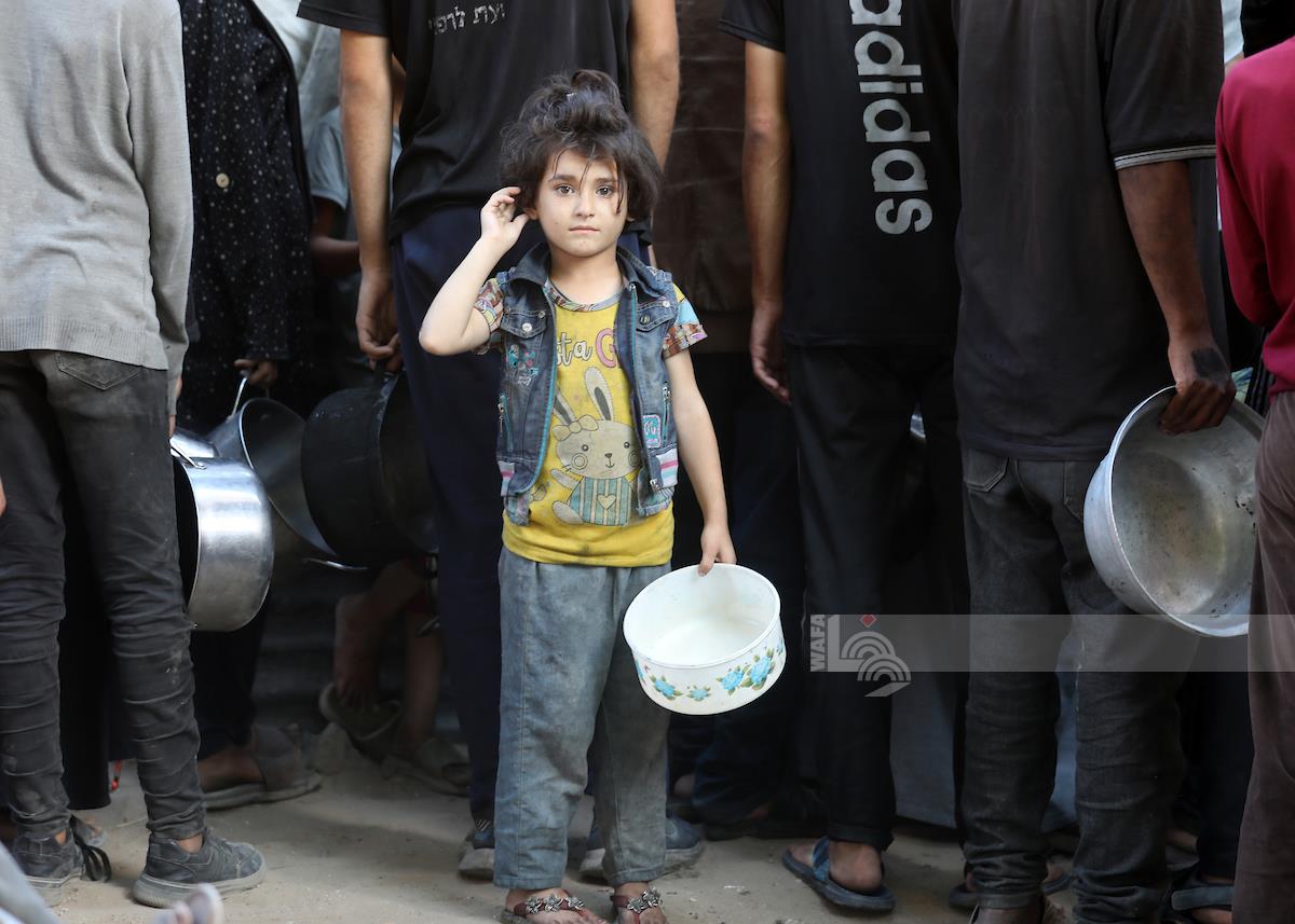 18 בני אדם מתו בעזה בתוך יממה. רופאים ברצועה קושרים זאת לרעב