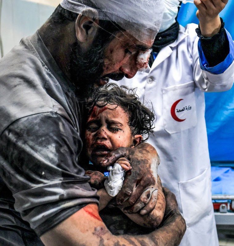 רופא יהודי-אמריקאי מאשים את כוחות הכיבוש הישראלי בהרג מכוון של ילדים פלסטינים