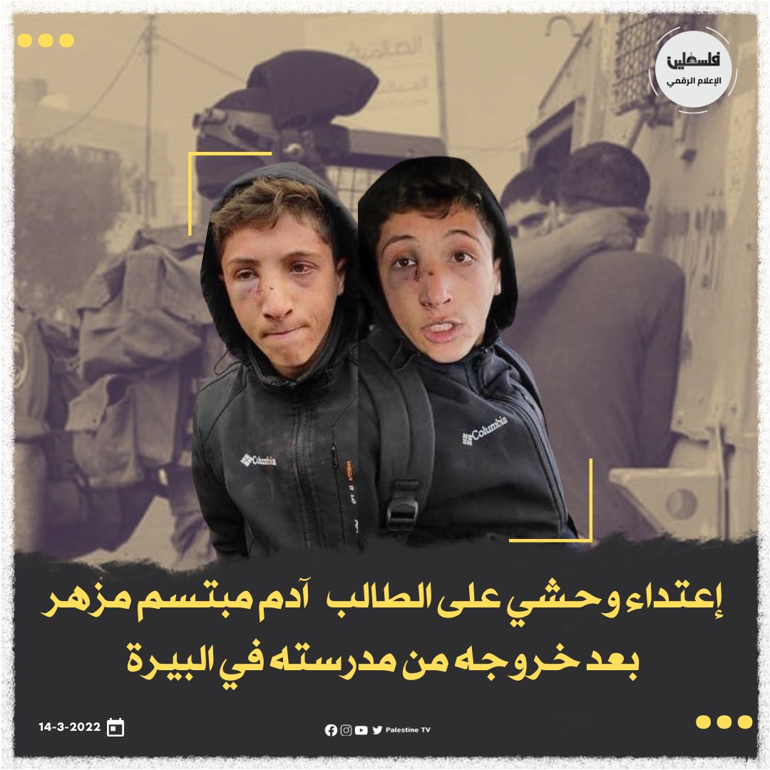 חיילי הכיבוש שברו אפו של תלמידי