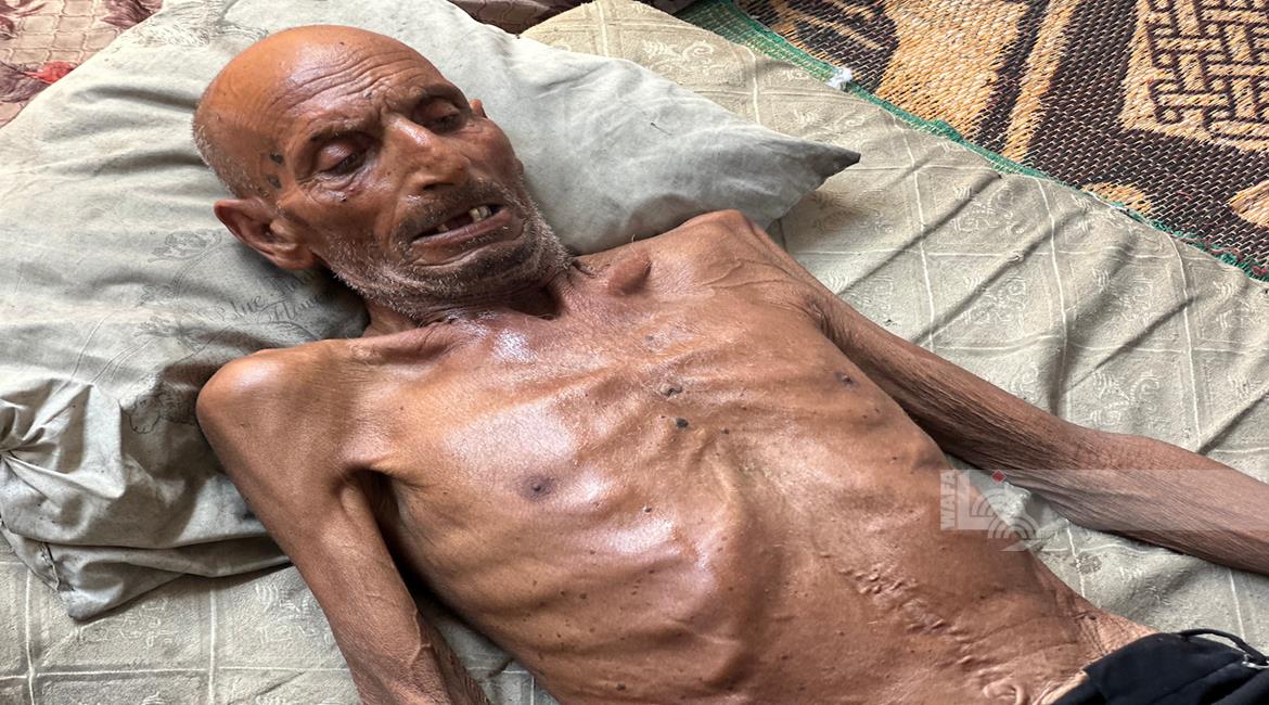 11 קורבנות רעב ותת־תזונה ברצועת עזה ביממה האחרונה