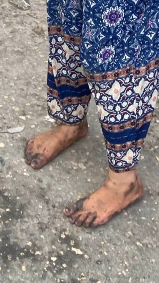 רצועת עזה: מחסור בנעליים ויוקר המחיה תחת המצור מגבירים את הסבל