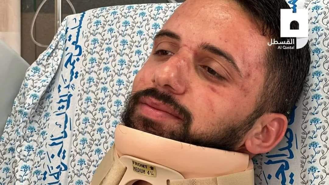 שברו לו את הצוואר שוטרי בר לב בהלוויה