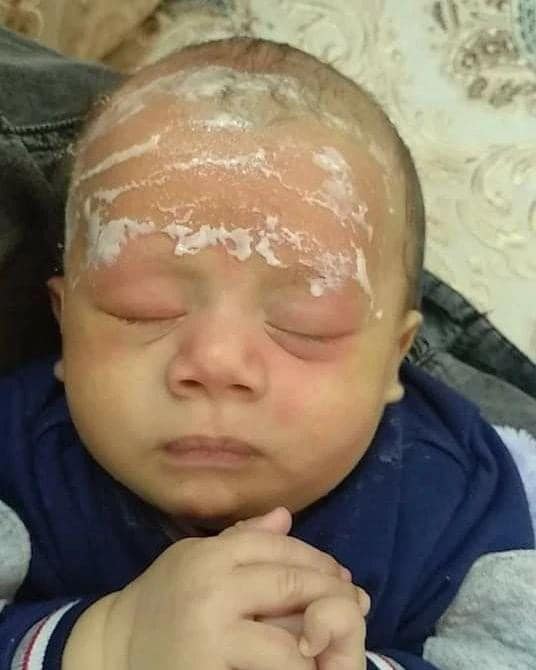  הגז והיהודים  