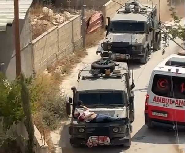 ילד פלסטיני נפצע מאש כוחות הכיבוש הישראלי בבית פוריק