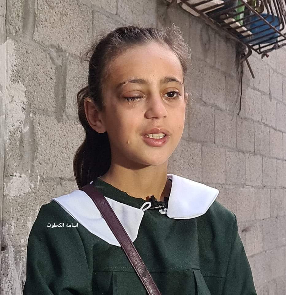 חזרה לבי"ס עם עין אחת הודות לטייס ישראלי