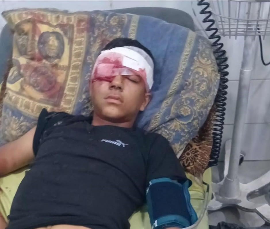 ילד נפצע במהלך פשיטה של כוחות הכיבוש בבית עווא, דרום־מערב חברון