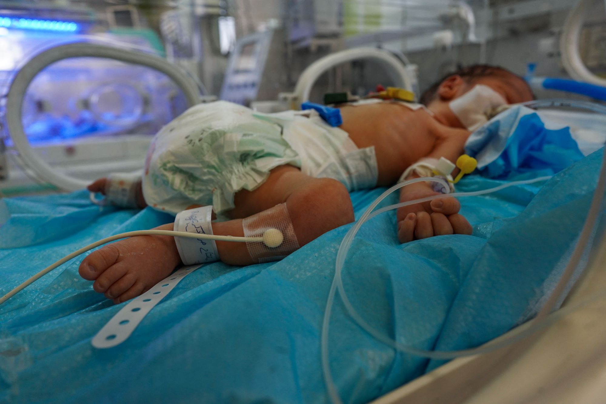 טרגדיה מתמשכת בעזה: תינוק נוסף מת מקור, אחיו התאום במצב קריטי