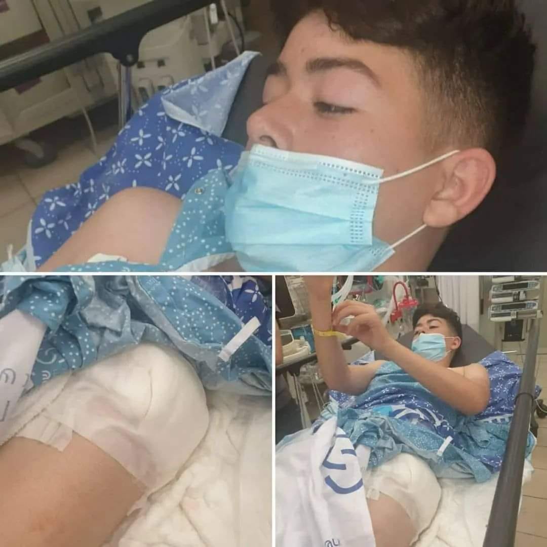 הילד שנורה  בידי חייל שוחרר למעצר בית