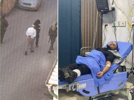 כוחות הכיבוש תקפו ארבעה תושבים וחקרו בשטח עשרות נוספים בג׳בע, מדרום לג׳נין