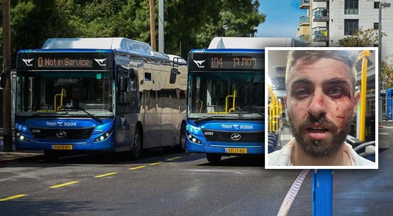 מתנחלים תקפו באלימות תושב פלסטיני ממזרח ירושלים