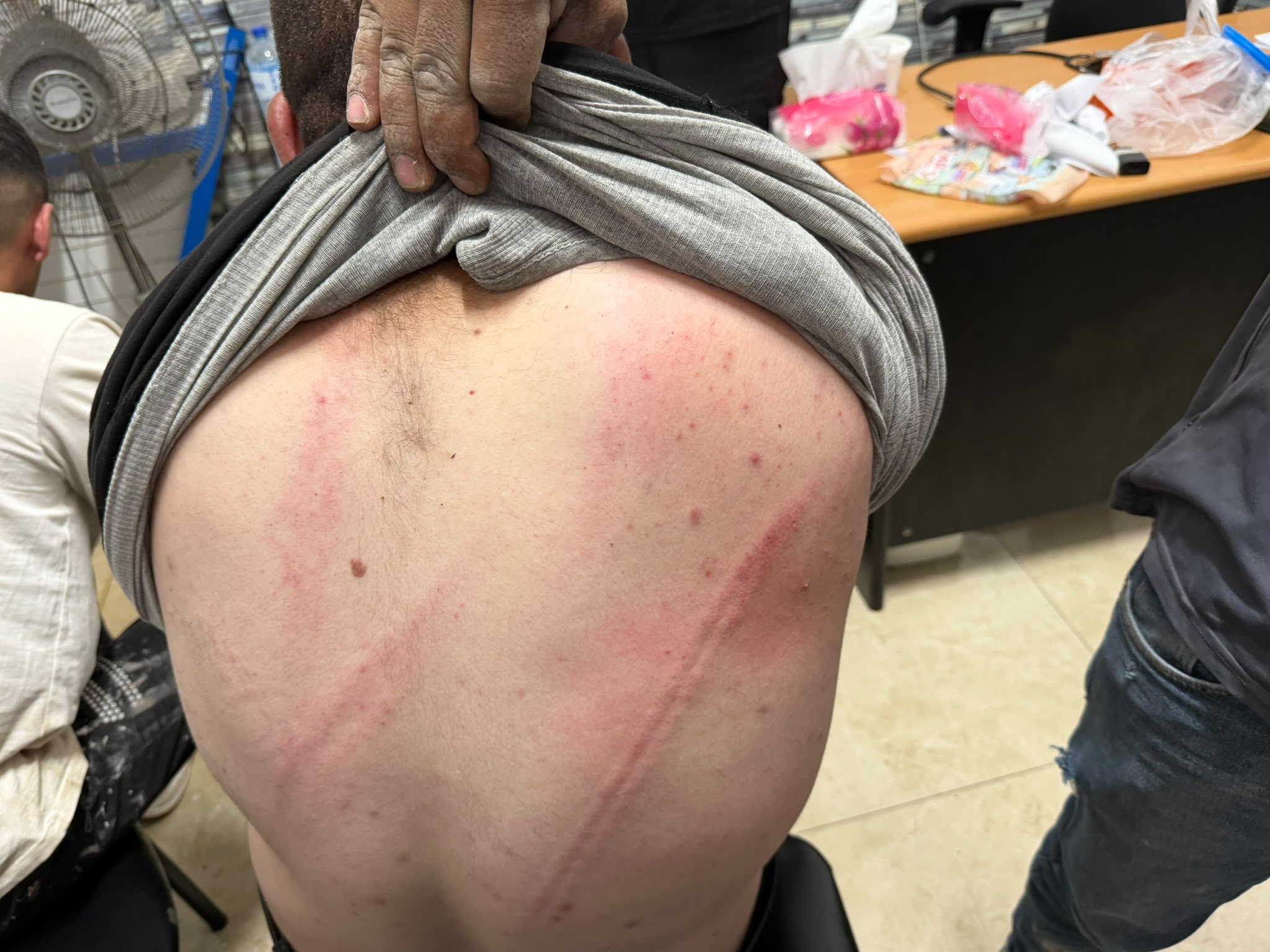 מתנחלים הכו תושב ממערב ליריחו תחת הגנת כוחות הכיבוש