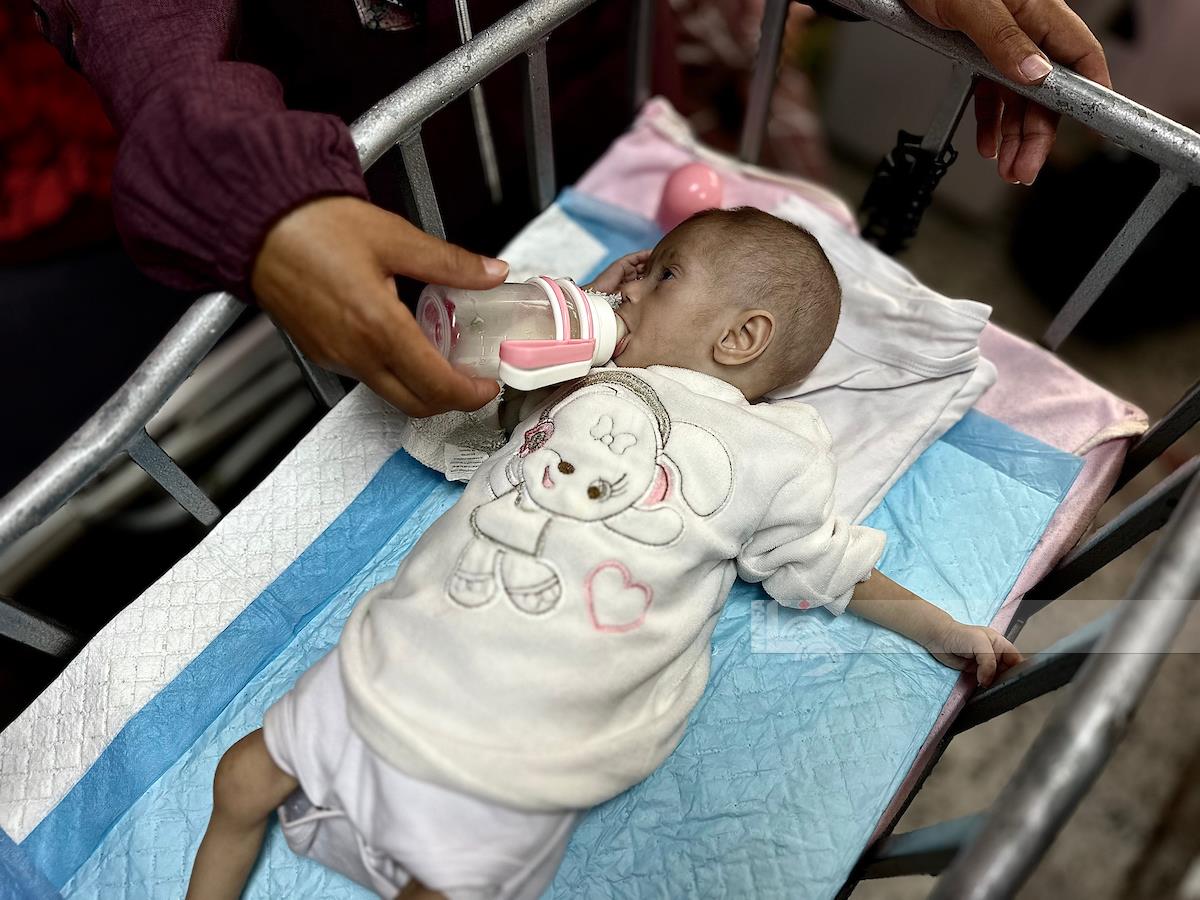 ארגון הבריאות העולמי: 100 אלף ילדים ברצועת עזה יסבלו מתת־תזונה חריפה עד אפריל הקרוב