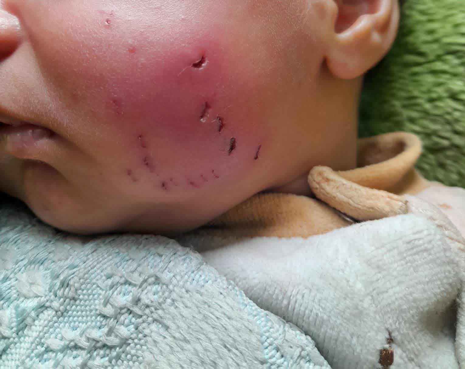 חיי ילדים במחנות העקורים בעזה תחת איום מתמשך של מכרסמים