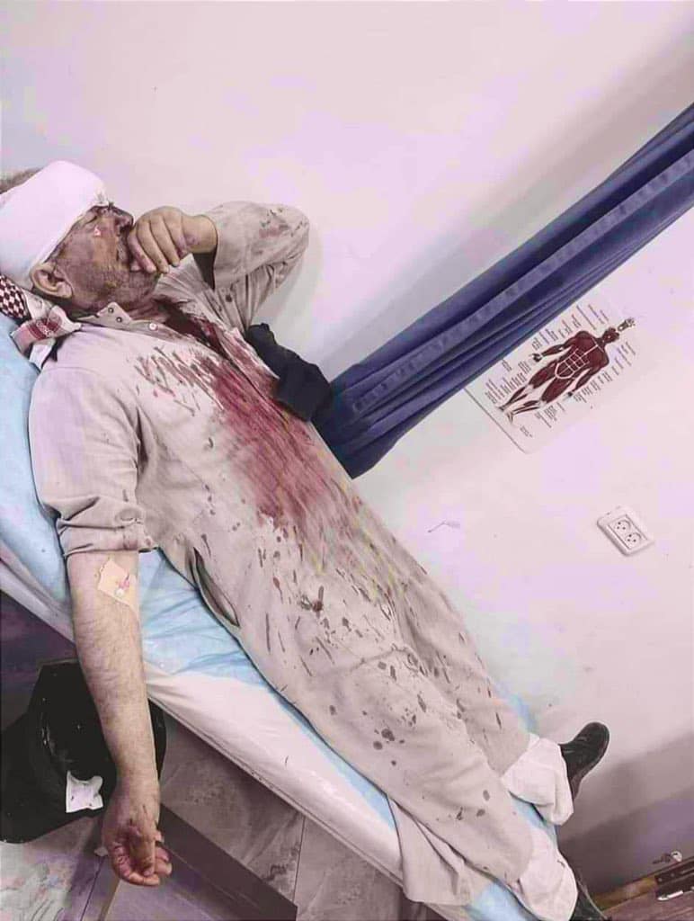 מתנחלים תקפו באלות 