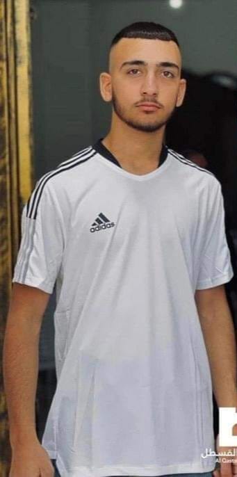 שברים בגולגולת ובאף מירי שוטר באלאקצא