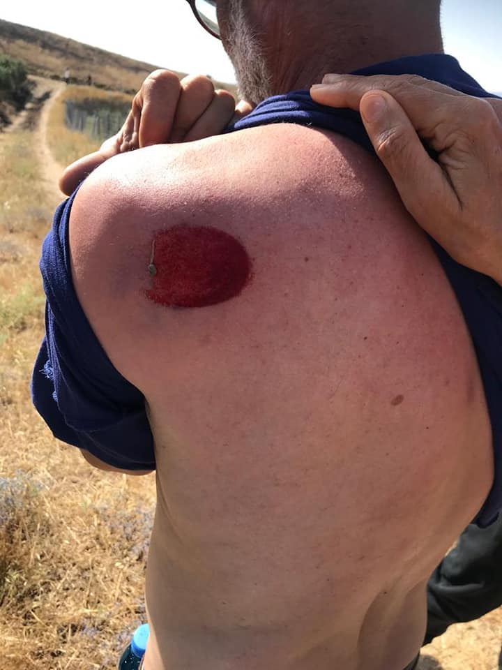 חיילי הכיבוש ירו כדורי גומי בשני פעילים נגד הכיבוש