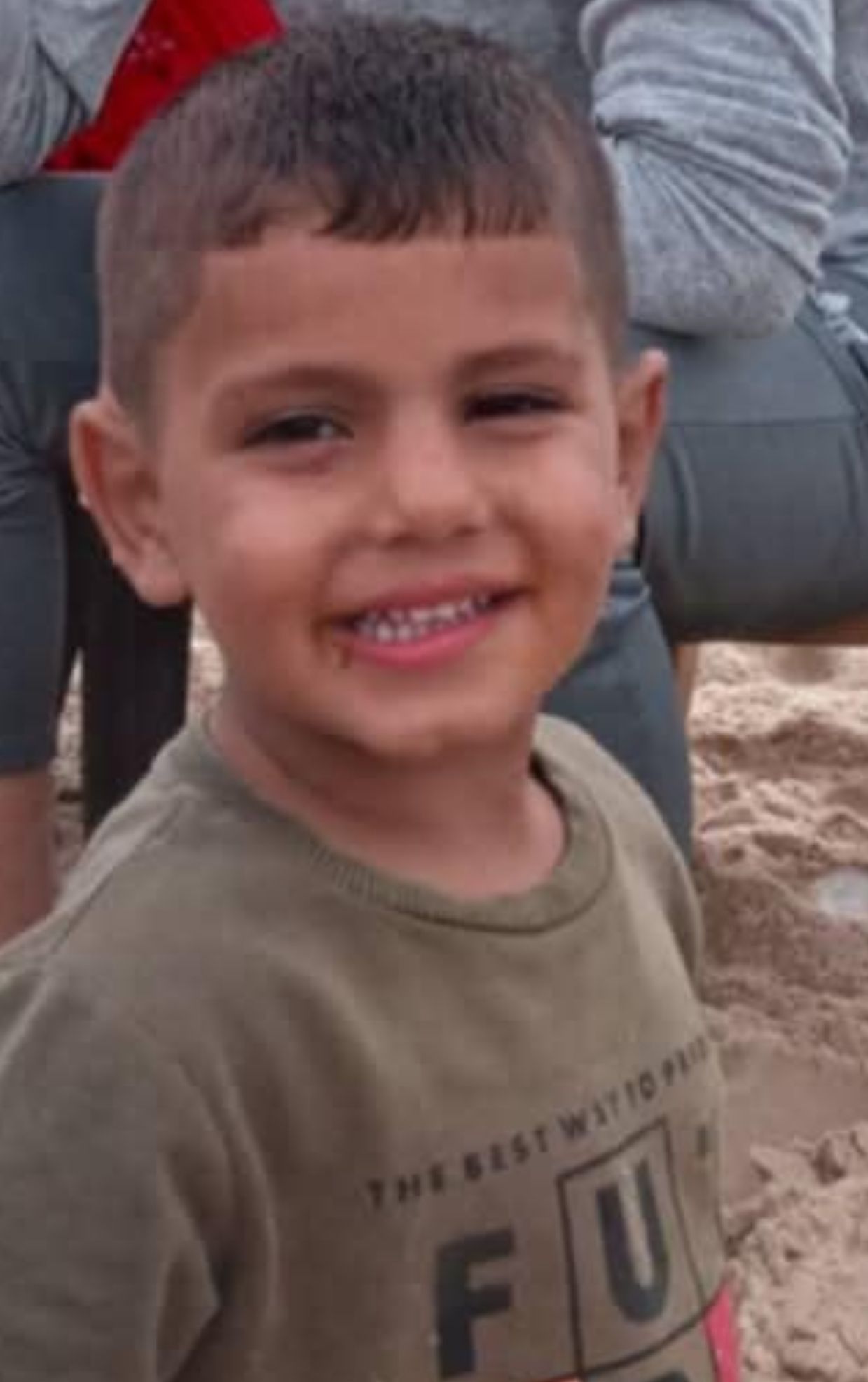 אסון בעזה: ילד בן 5 נפל לסיר רותח במהלך חיפוש אחר מזון למשפחתו