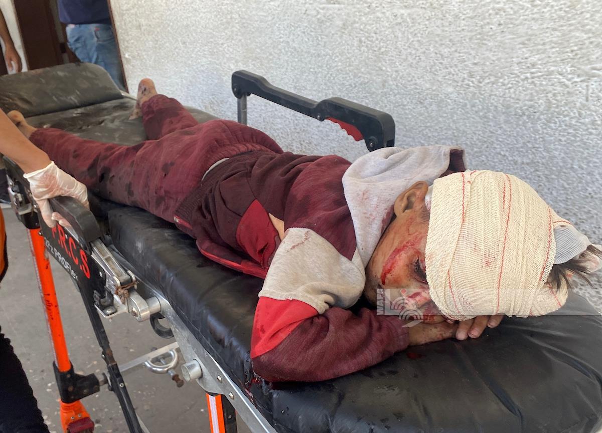 מספר הרוגים ופצועים בתקיפה של כוחות הכיבוש על העיר עזה