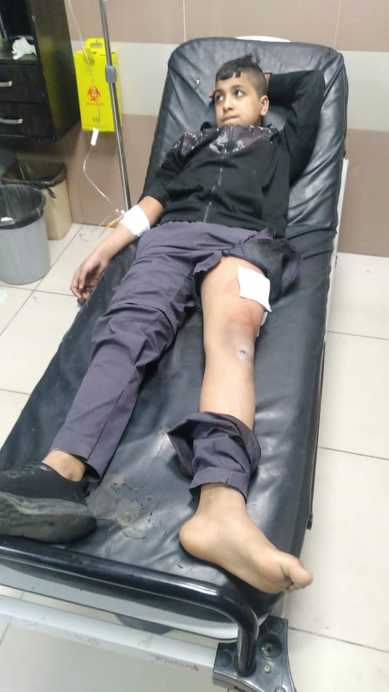 ילד נפצע מירי מסתערבים ברמאללה