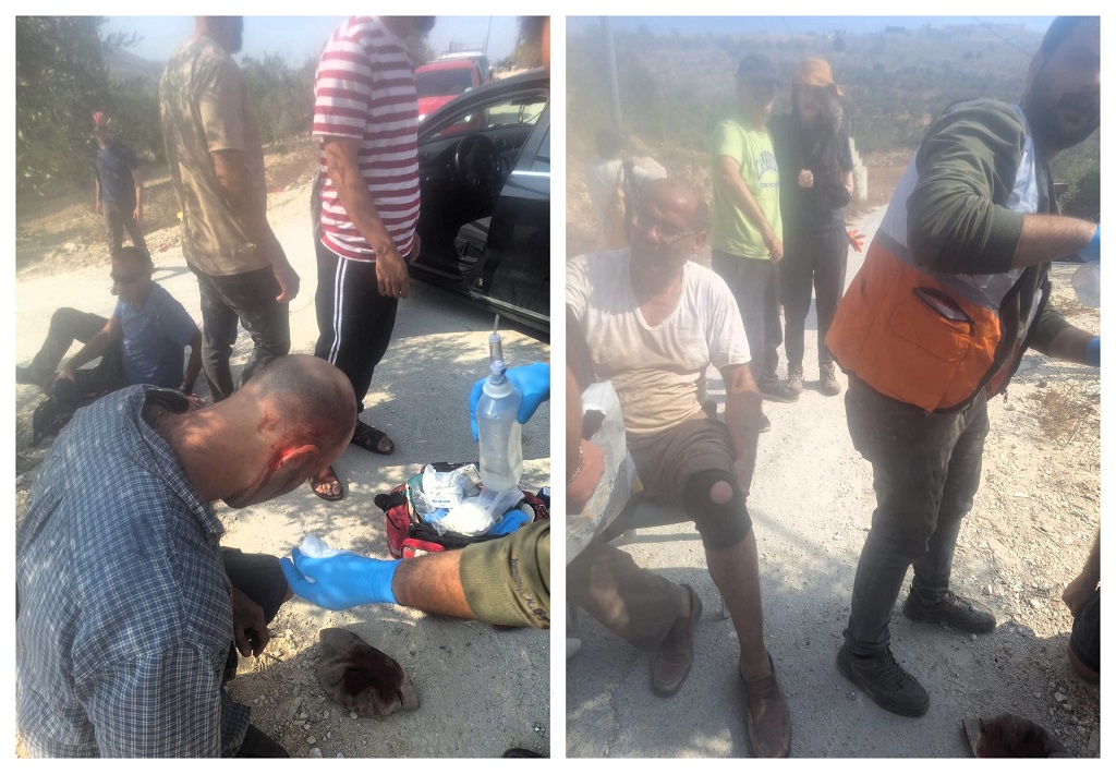 פצוע פלסטיני וארבעה פעילים זרים בתקיפת מתנחלים בבורין