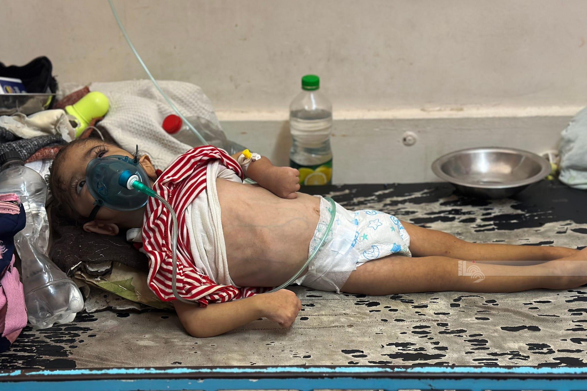 משבר בריאותי חמור מאיים על חיי פגים ותינוקות בעזה