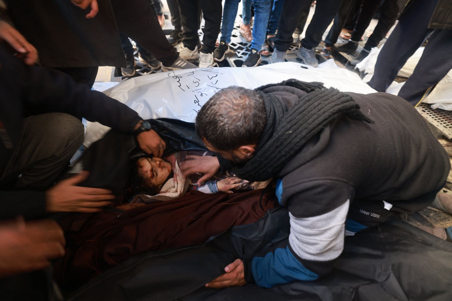 אשה וילדה נפצעו באורח קשה מתקיפה של כוחות הכיבוש בבני סוהילה